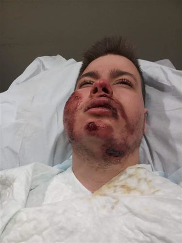 Jongeman aangereden en bestolen - Beringen